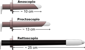 Anoscope,_proctoscope_and_rectoscope-IT